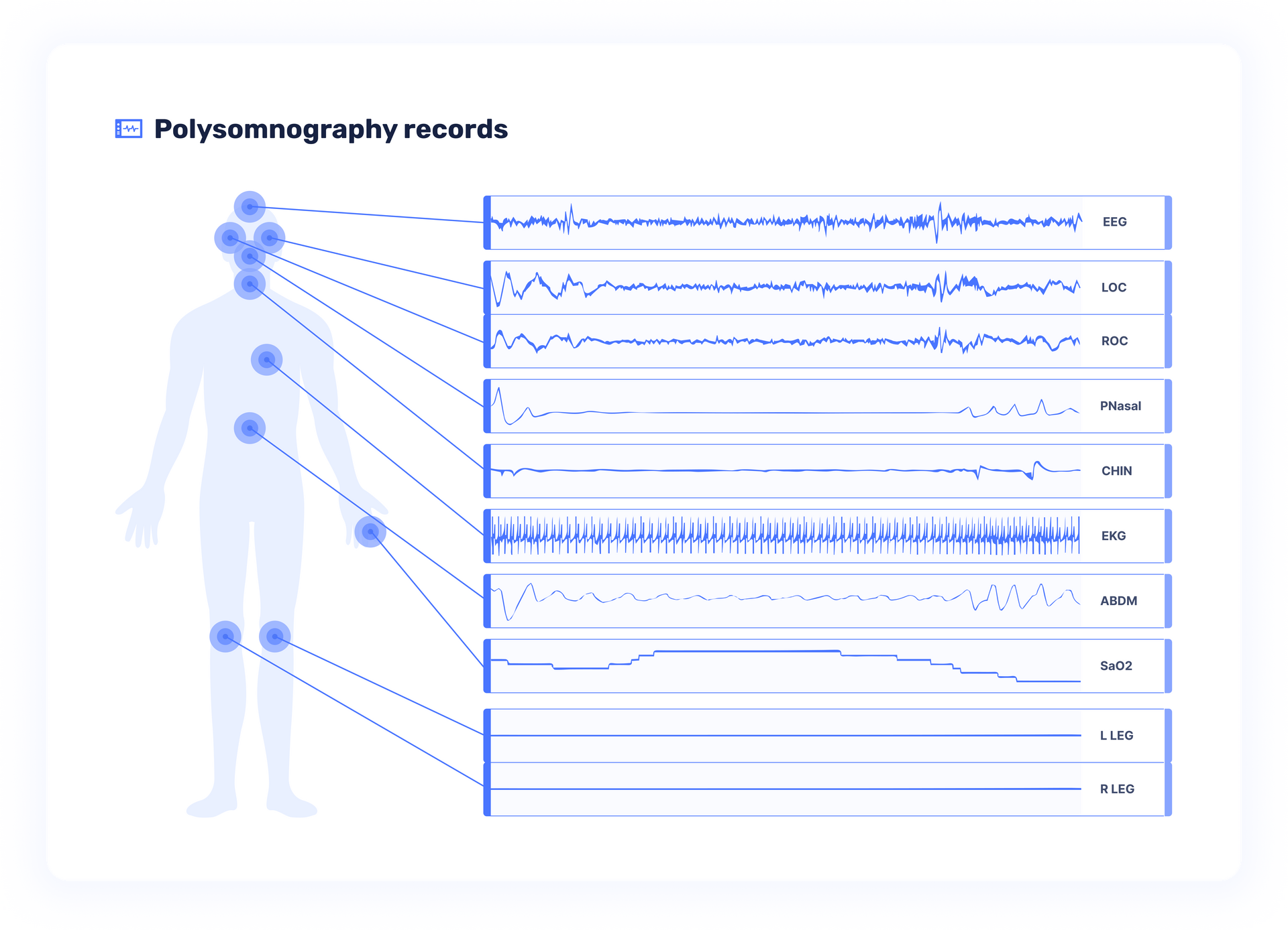 Example of a polysomnography record